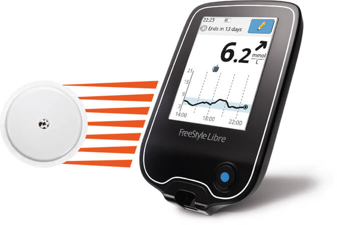 abbotts freestyle libre flash glucose monitoring